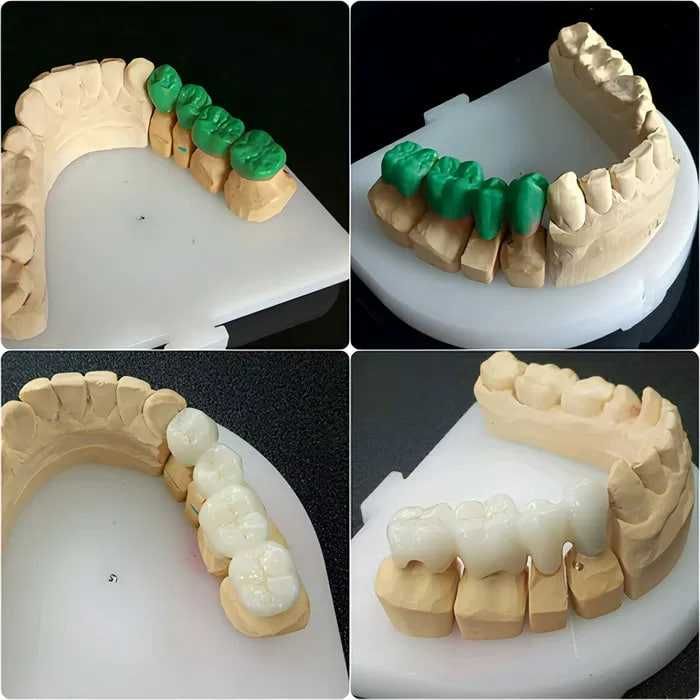 Зуботехническая CAD/CAM услуги в стоматологии
