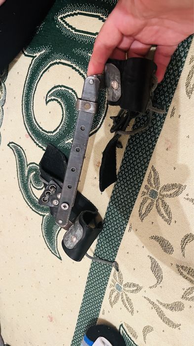 Шина при дисплазии