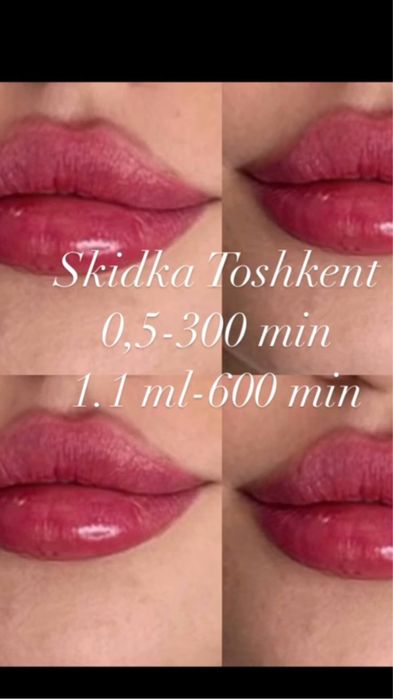 Лабга филлер  ва филлер ердамида дахан чикариш