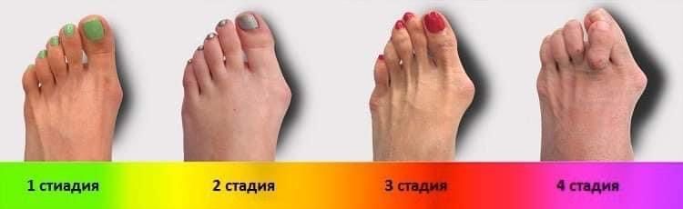 НУГА БЕСТ. Массажёр для ног Е5 от офиц. дилера РУз.