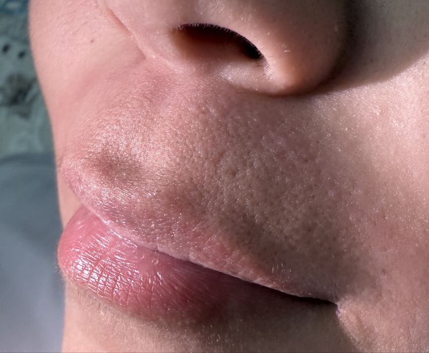 Шугаринг сахар~воск.