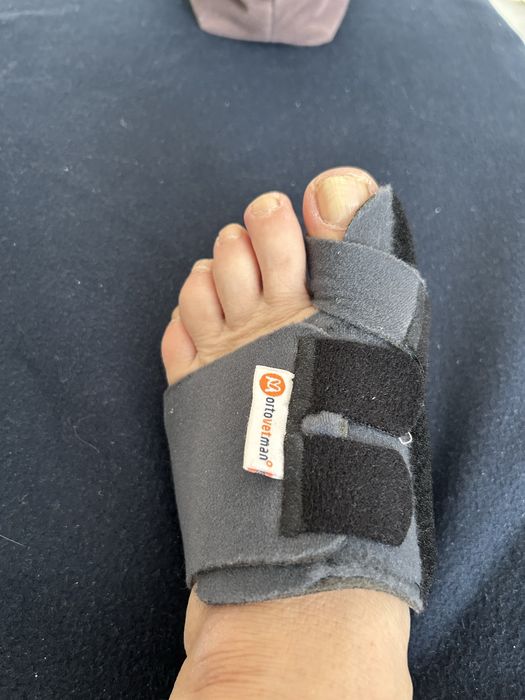 Нощна шина за Hallux Valgus