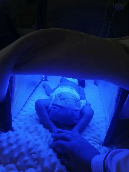 Уф лампа от желтушки