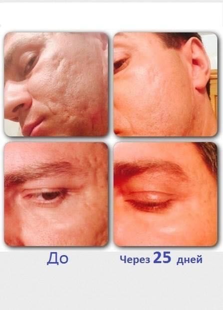 Домашна терапия за лице Lumenesce от Jeunesse Global