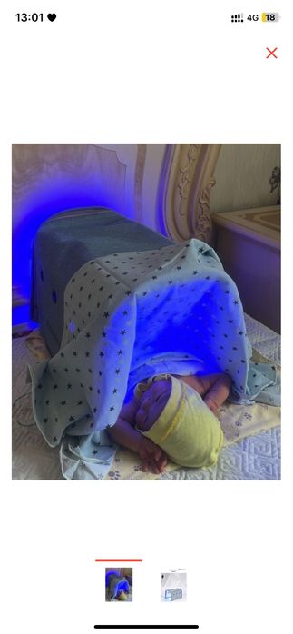 Фотолампа от желтухи