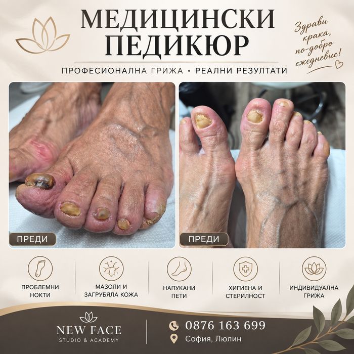 Медицински педикюр – професионално решение при проблемни стъпала