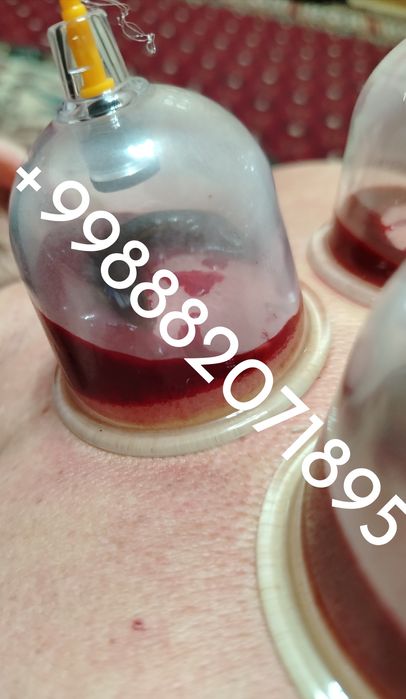 Hijoma Misr va Germaniya metodikasi