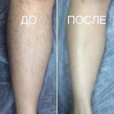 Ваксинг/ шугаринг / опытный мастер
