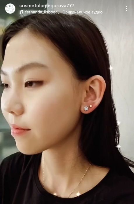 Прокалывание ушей