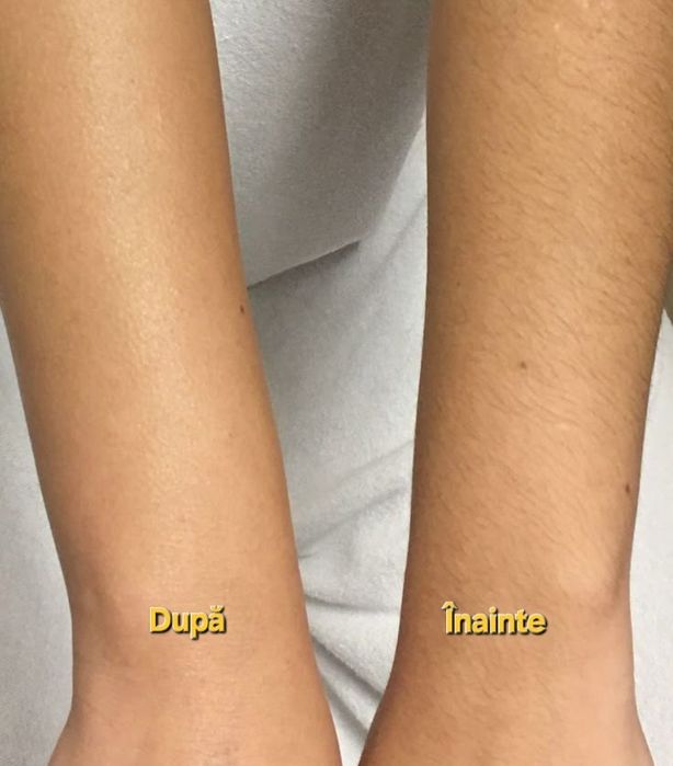 Înfrumusețare profesională