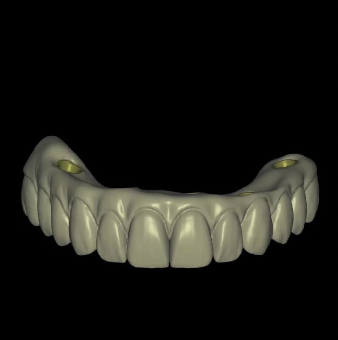 Моделировщик Exo Cad (удаленно) Зубной техник