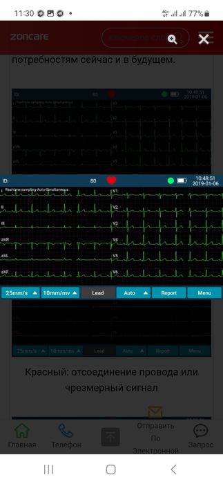 ЭКГ 3 каналный ZONCARE E 10. 
Extreme Simplicity 3-Ch ECG Machine

Нов