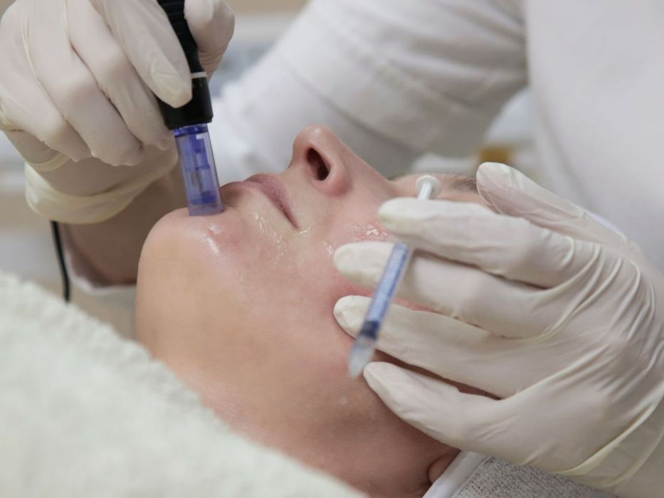 Derma-pen за мезотерапия и др….