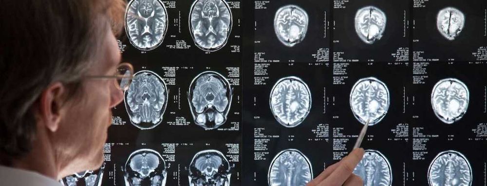 ВТОРО МНЕНИЕ ЗА КОМПЮТЪРНА ТОМОГРАФИЯ РЕНТГЕН СКЕНЕР ЯДРЕНО-МАГНИТЕН РЕЗОНАНС МАМОГРАФ.Разчитане на Образни Изследвания-КТ CT ЯМР MR Рентгенова снимка