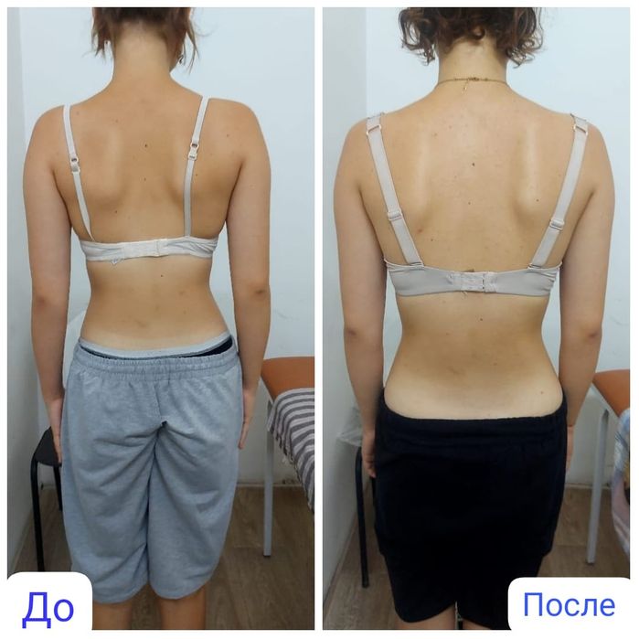 Мануальная терапия/массаж/иглотерапия