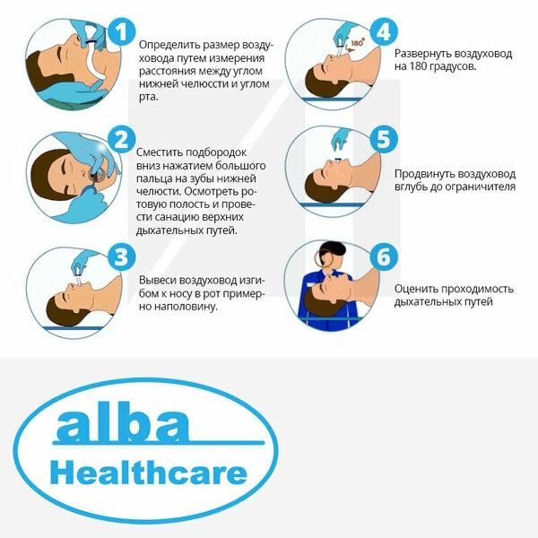 Воздуховод Гведела ротоглоточный воздуховод