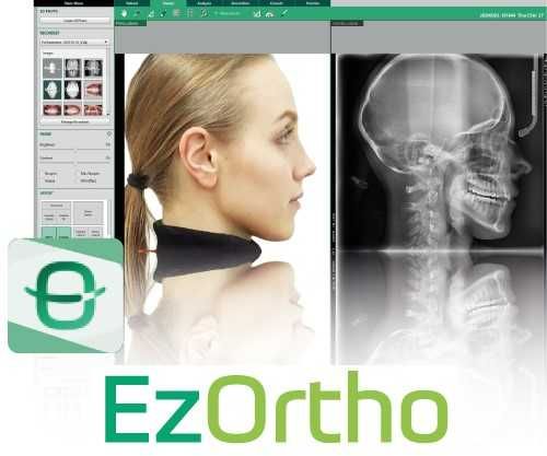 Maestro3D + 3Shape Ortho+ OnyxCeph + Invivo7 + Dolphin12 + GAMMA