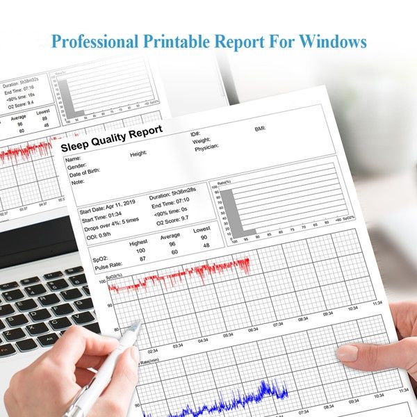 Viatom / Wellue O2 Ring™ - Кислороден монитор с пръстен