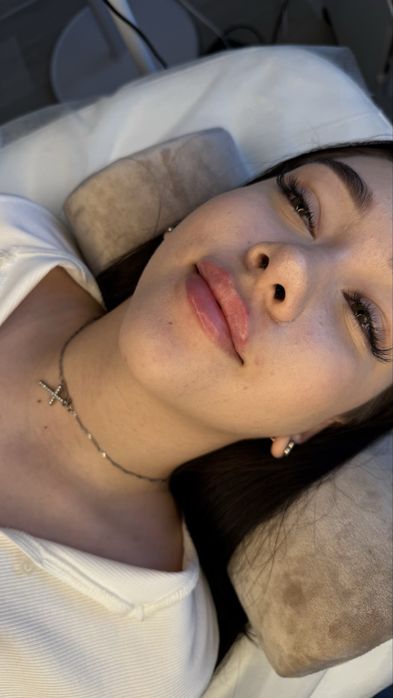 Контурная пластика губ