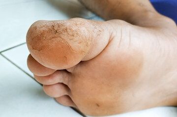 Смарт педикюр на дому