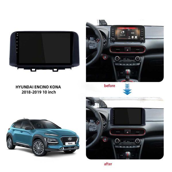 Hyundai ENCINO/Kona 2017/2020 10'' андроид навигация, 9394-1DIN