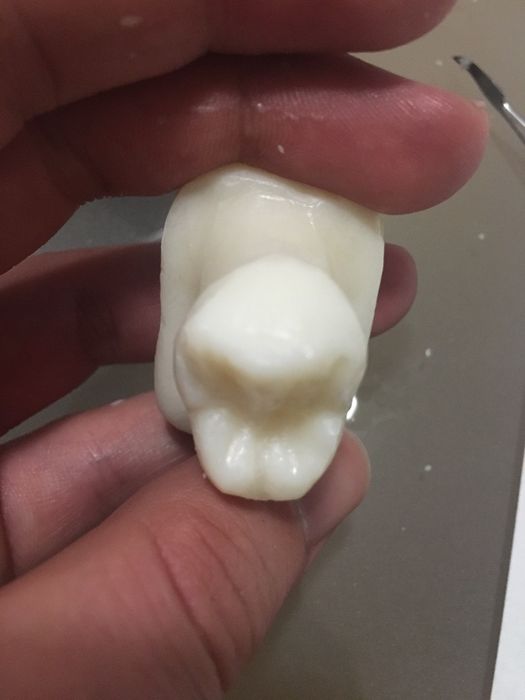 Моделирам зъби от сапун