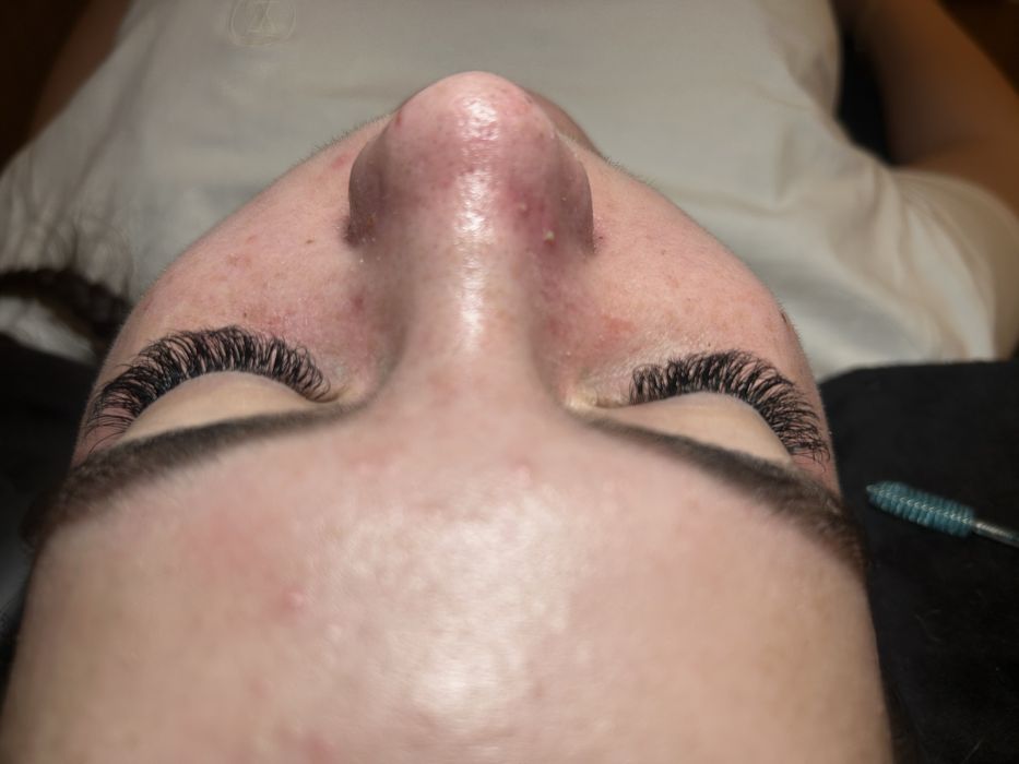 Extensii gene (1D, 2D, 3D, 4D)