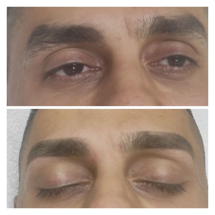 Epilat trat.cosmetice pensat machiaj micropigmentare cartier latin