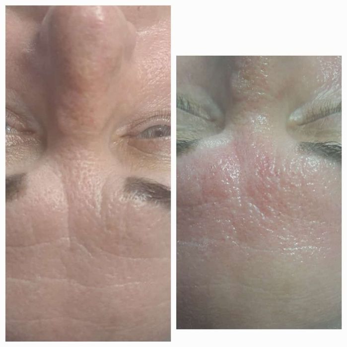 Обучение массажист,косметолог эстет