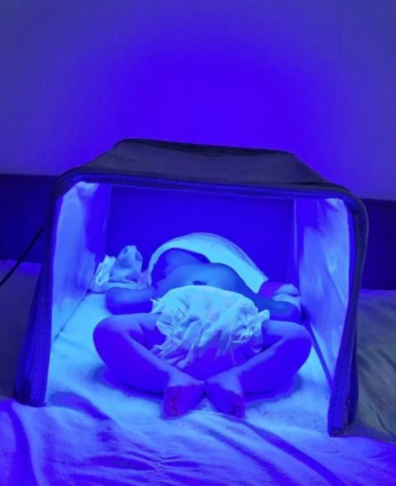 Лампа от желтухи