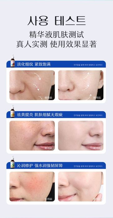 Сыворотка витамином С