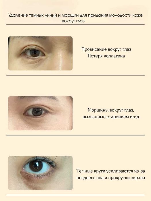 Крем для кожи вокруг глаз, устраняет морщины, успокаивает и увлажняет