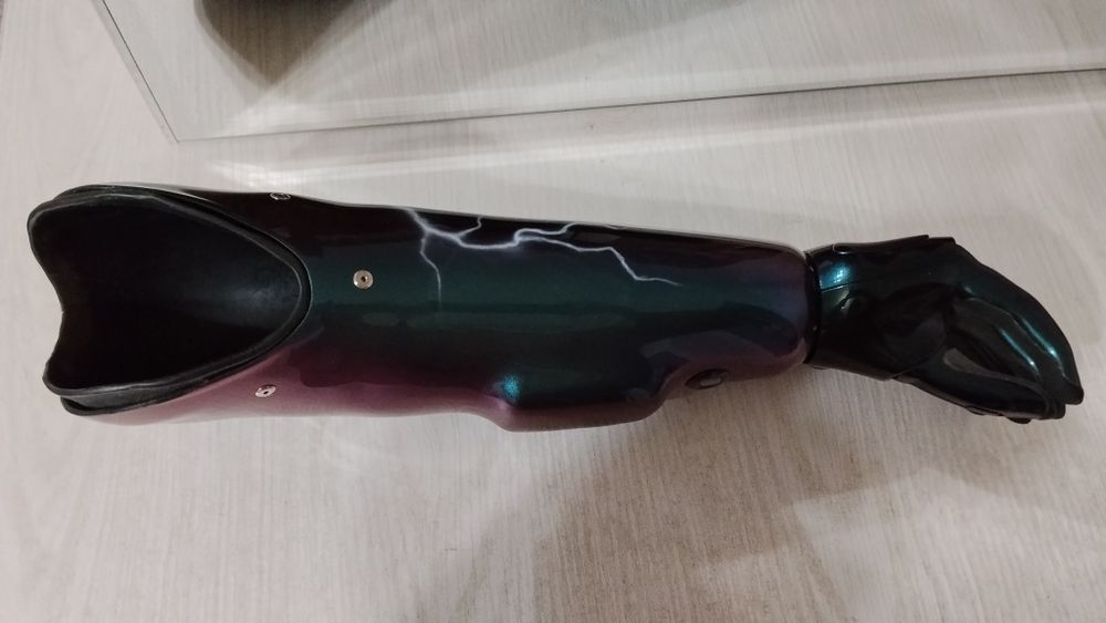 Бионический протез