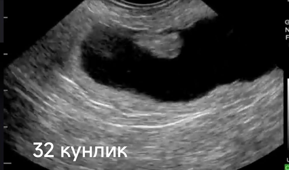 Узи диагностика хизмети