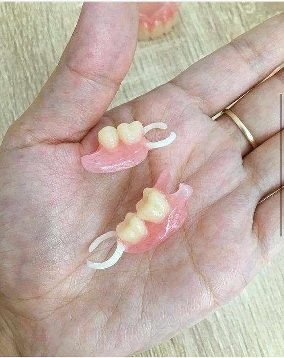 Съёмные протезы,зубные протезы,починки ремонт протеза