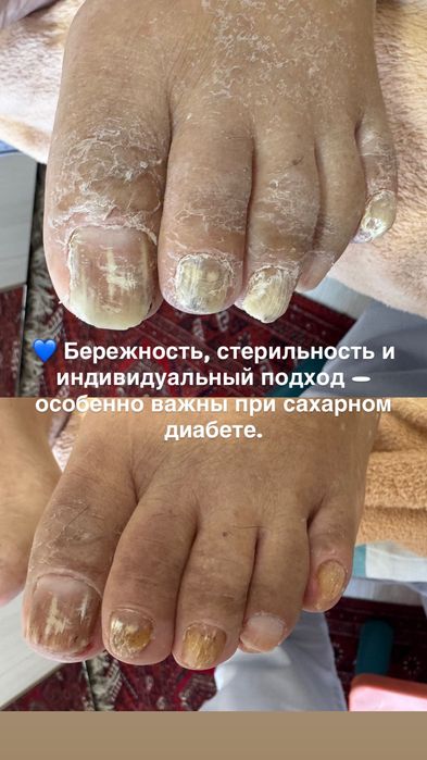 .	Подолог в Талгаре