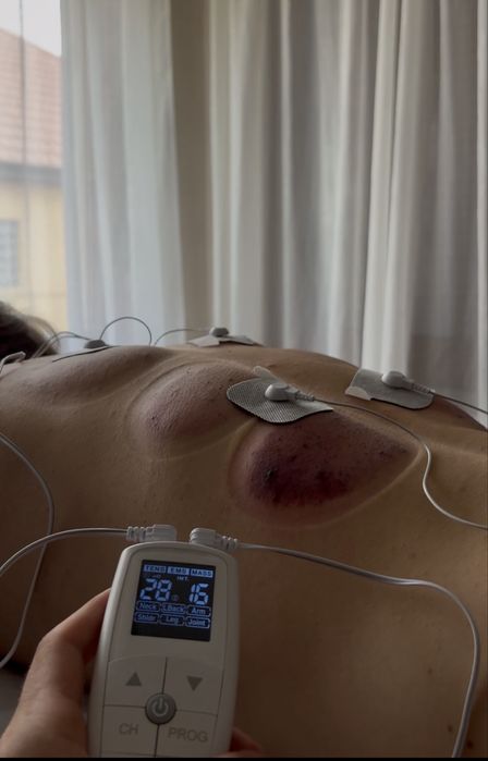 Recuperare Kinetoterapie Domiciliu - Masaj - Electroterapie - AVC - Hernie de disc - Protezare - Scolioză - Cifoza - Umar dureros
