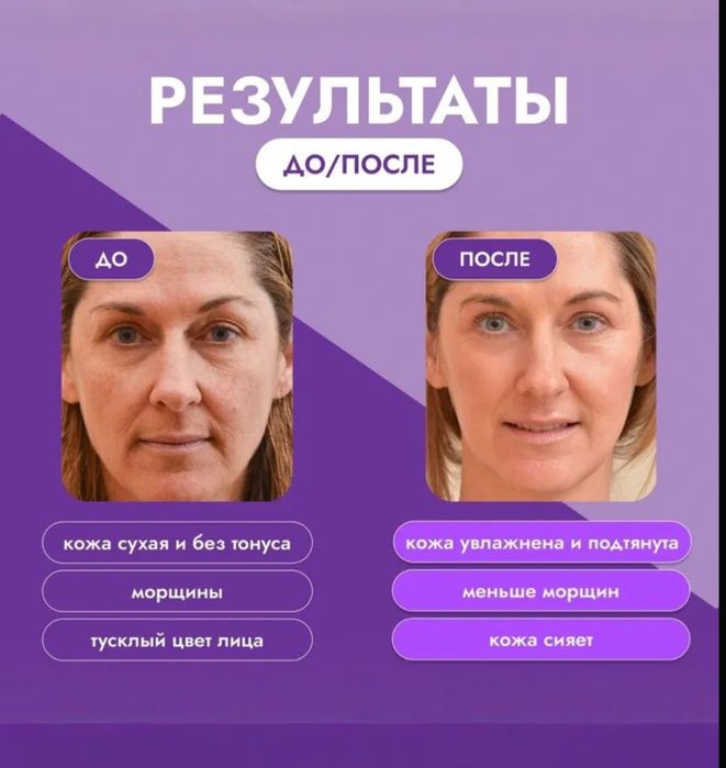 Гиалуроновая кислота и Коллаген 60 мл