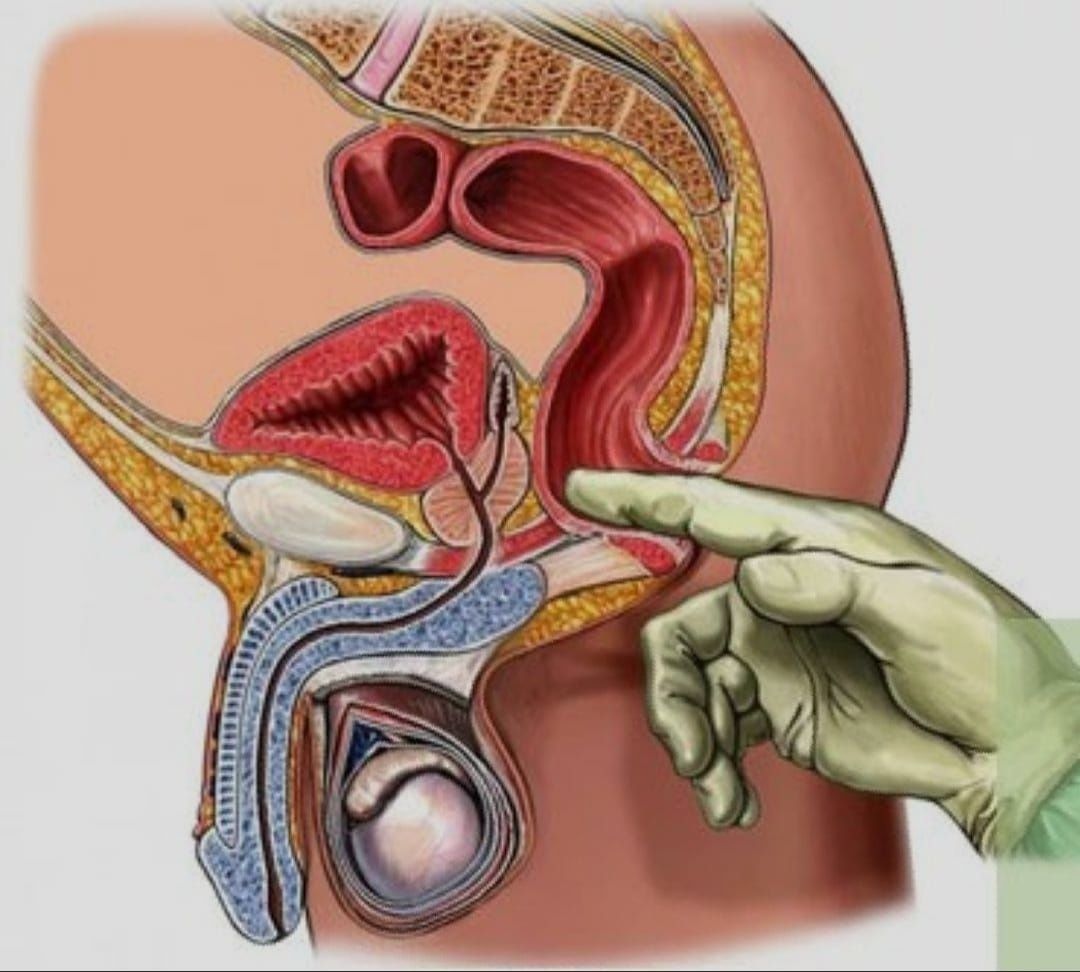 порно как делать массаж предстательной железы фото 47