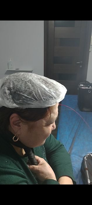 Хиджама профессиональный