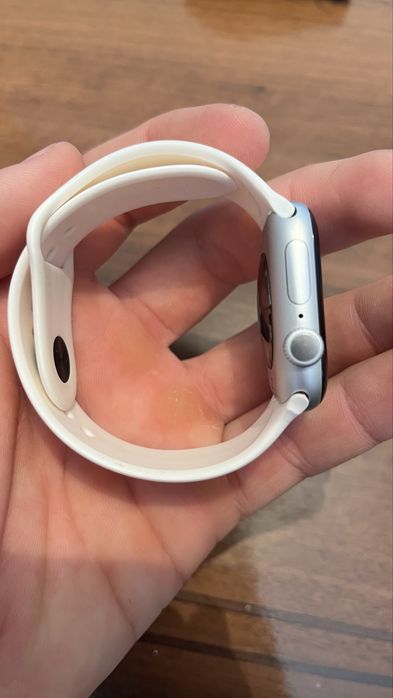 Apple watch series 10