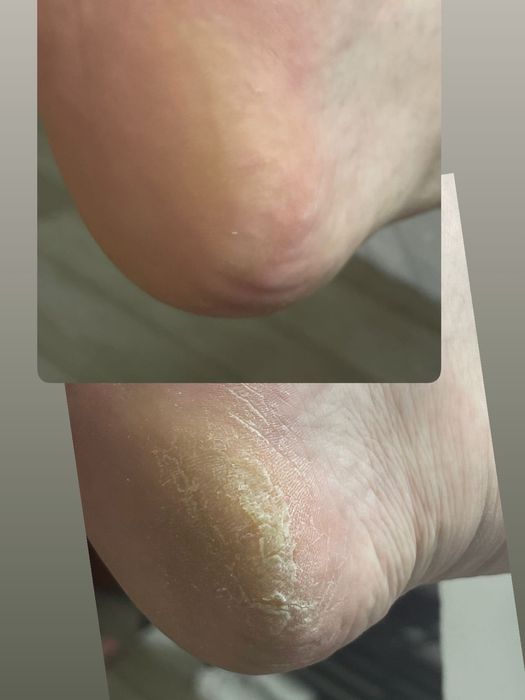 Подолог, Маникюр, Педикюр