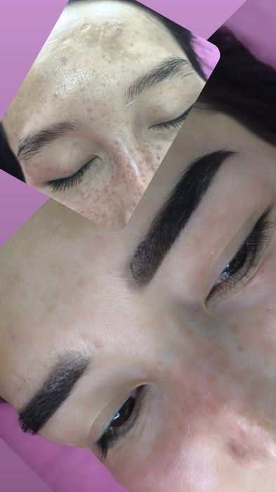 Косметолог лазеролог со стажем 10лет