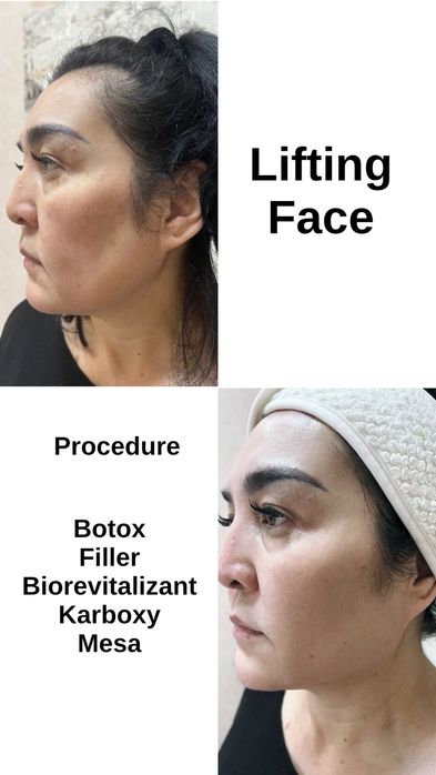 Косметолог эстет все уход и инъекционные процедуры