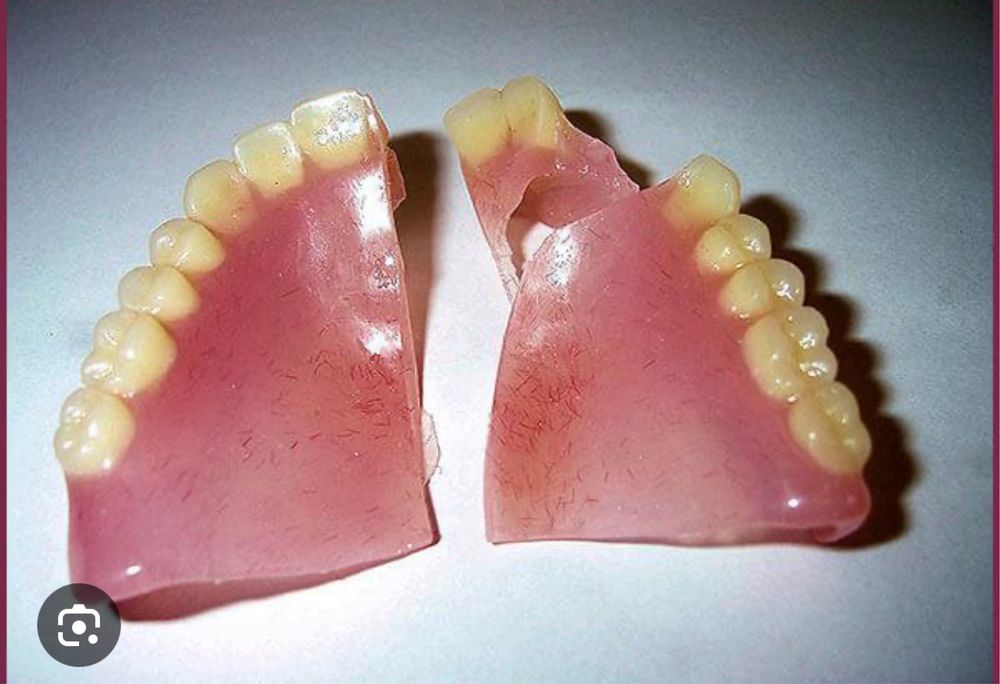 Протез зубной техник