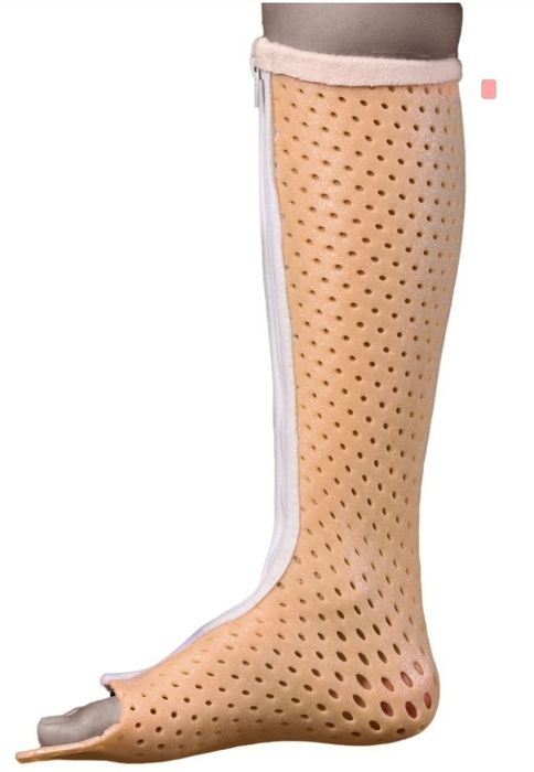 Гипс съёмный,  можно одеть на море , бассейн