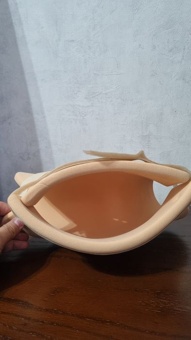 Мягкие шины при дисплазии