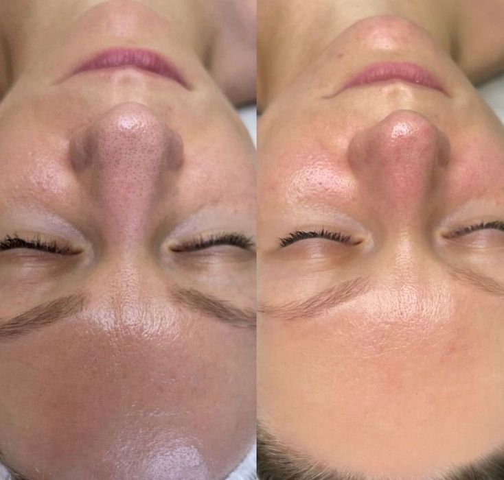 Косметолог для женщин и мужчин