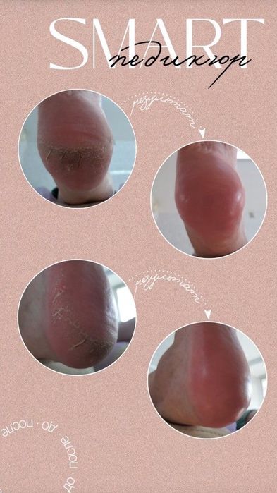 Педикюр маникюр титановая нить