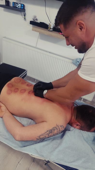 Chiropractică, Terapia Trigger Point ,IASM și Complementară